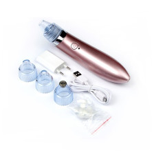 Массажер для чистки лица LuazON LMZ-050, АКБ, вакуумный, 4 насадки 2554134   