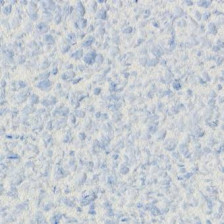 Жидкие обои "SILK PLASTER" Г-326 Рельеф 